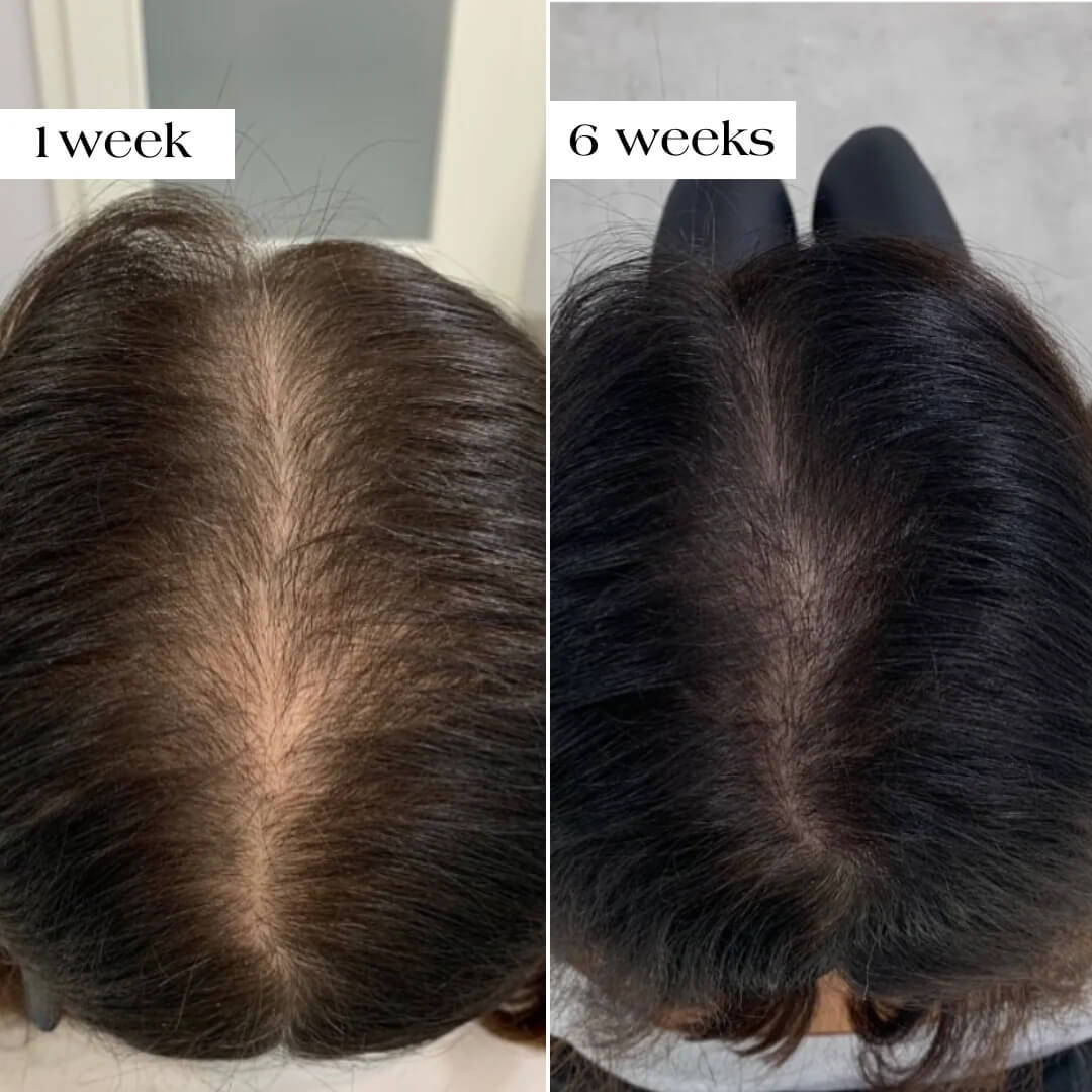 ThickBloom™ - Premium Natural Hair Re-Growth Formula for Fuller Hair
