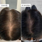 ThickBloom™ - Premium Natural Hair Re-Growth Formula for Fuller Hair